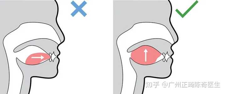 舌头的正确安放位置? - 知乎