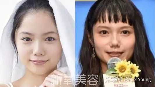 整容失败是种怎样的体验 Miss Young 的回答 知乎