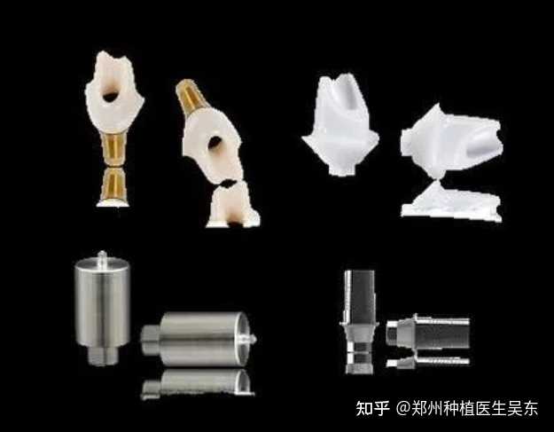 种植牙使用第三方基台可靠吗? - 知乎