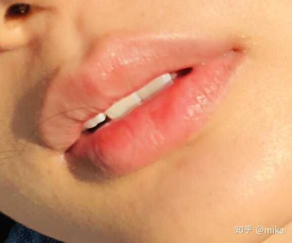 正常嘴唇