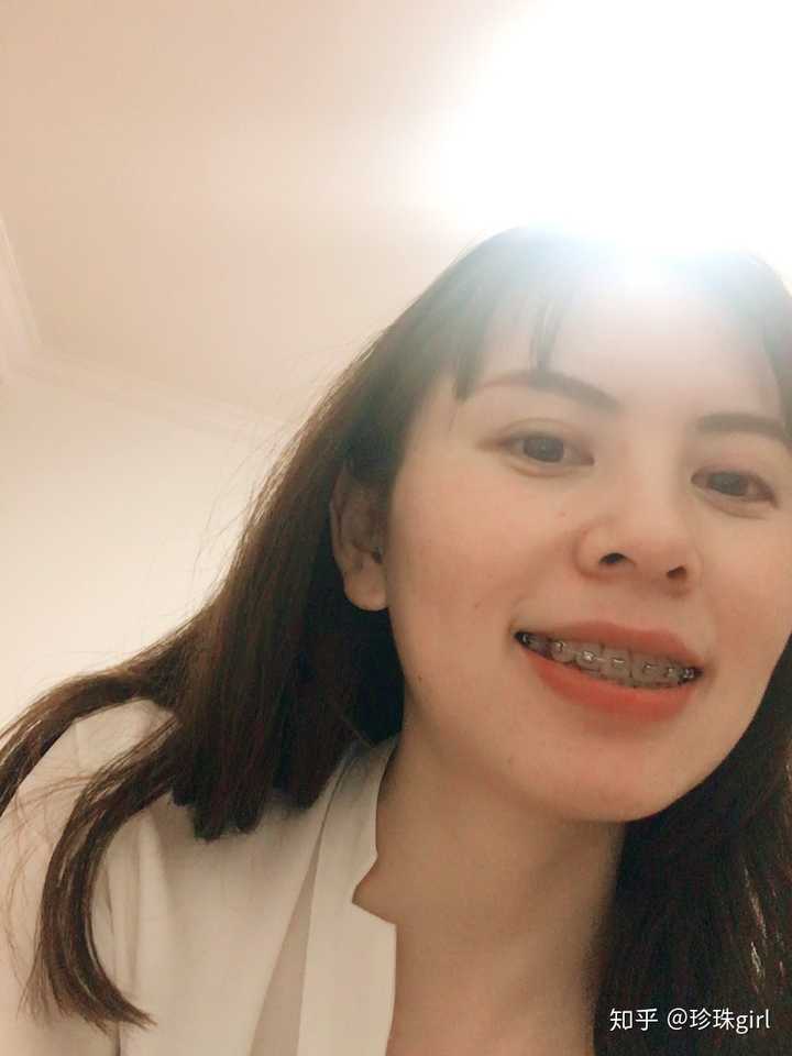 你们牙套都戴了多久啊？