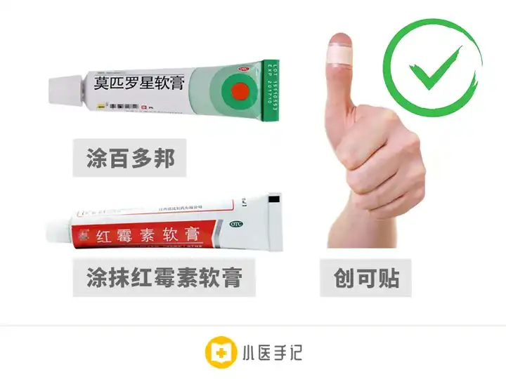 手指旁边总是长倒刺,蜕皮。为什么?怎么办? - 知乎