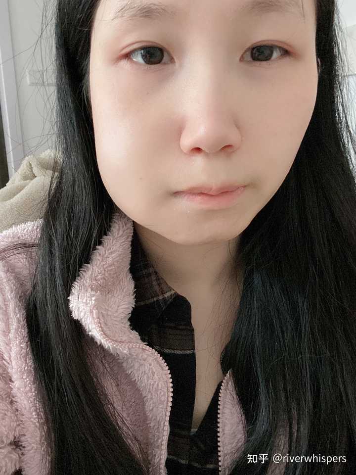 拔完智齿脸为什么会肿 知乎