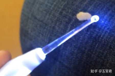 扁桃体结石是如何形成的 知乎 扁桃体结石是如何形成的 知乎
