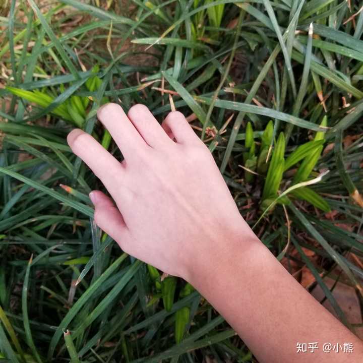 为什么手背的皮肤会比手臂上的白?