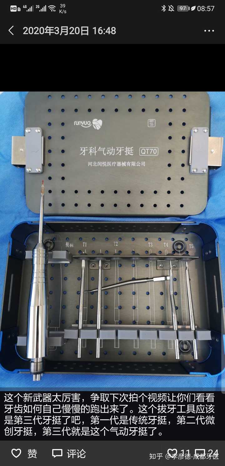 又过了半年了,更新了更温柔的拔牙工具.