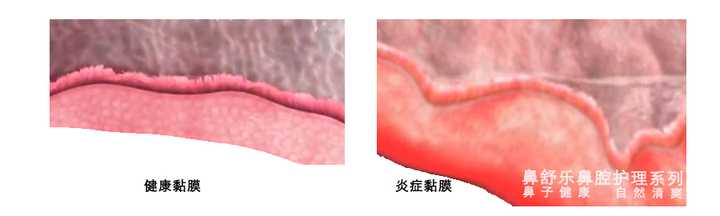 为什么鼻子总是只有一边通气 而且会轮流换呢 知乎