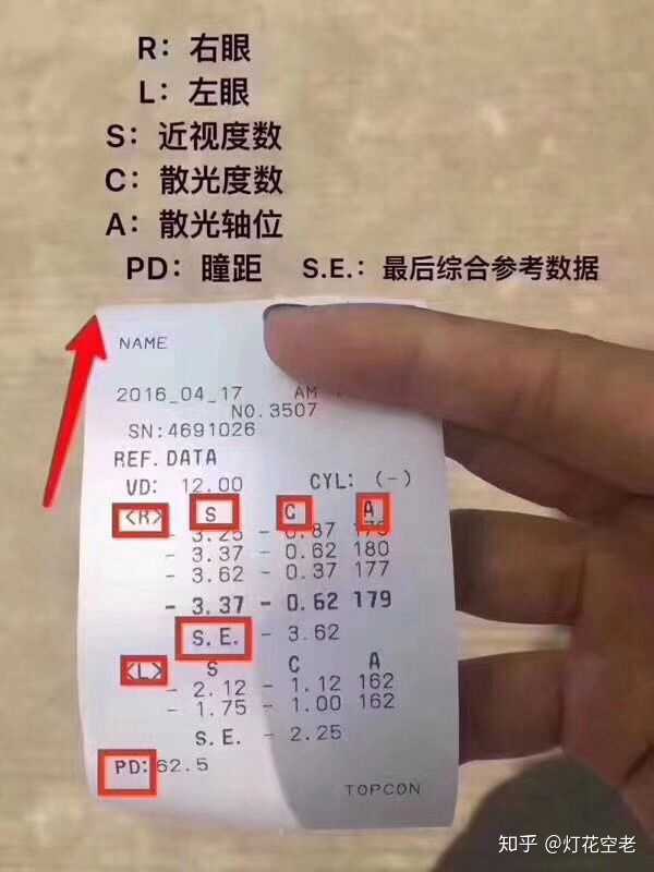 眼镜这个单怎么看?