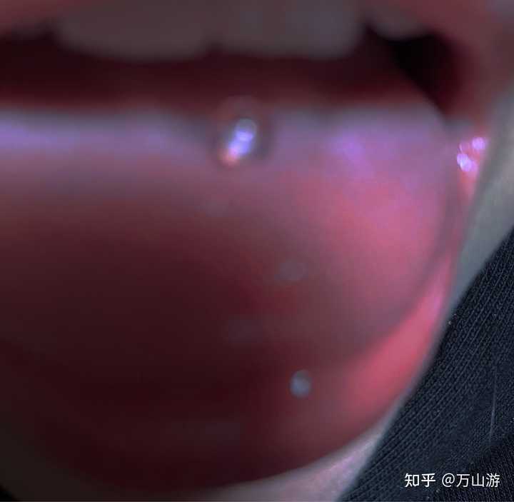 自己打舌钉最好打在哪里?打舌钉疼吗? - 知乎
