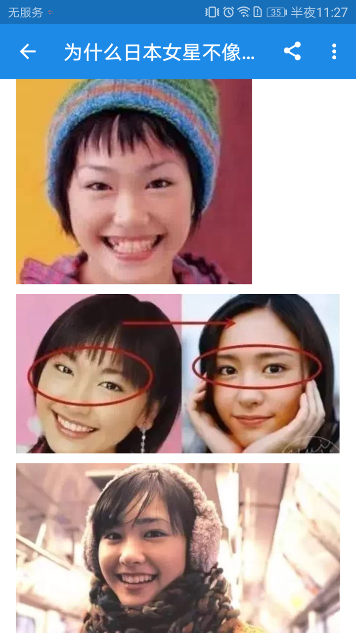 新垣结衣到底是整容啦还是长开啦 如果是整容为什么这么自然甜美 知乎 新垣结衣到底是整容啦还是长开啦 如果是整容为什么这么自然甜美 知乎