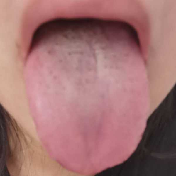 艾草肚脐贴真的可以祛湿减肥吗?附案例-守护佛网