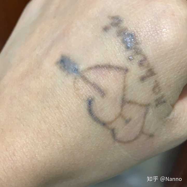 纹身部位还能激光脱毛么 知乎 纹身部位还能激光脱毛么 知乎