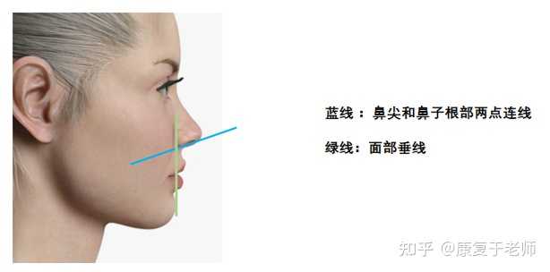 为什么一些普通人甚至明星年纪不大 但法令纹却很重 知乎