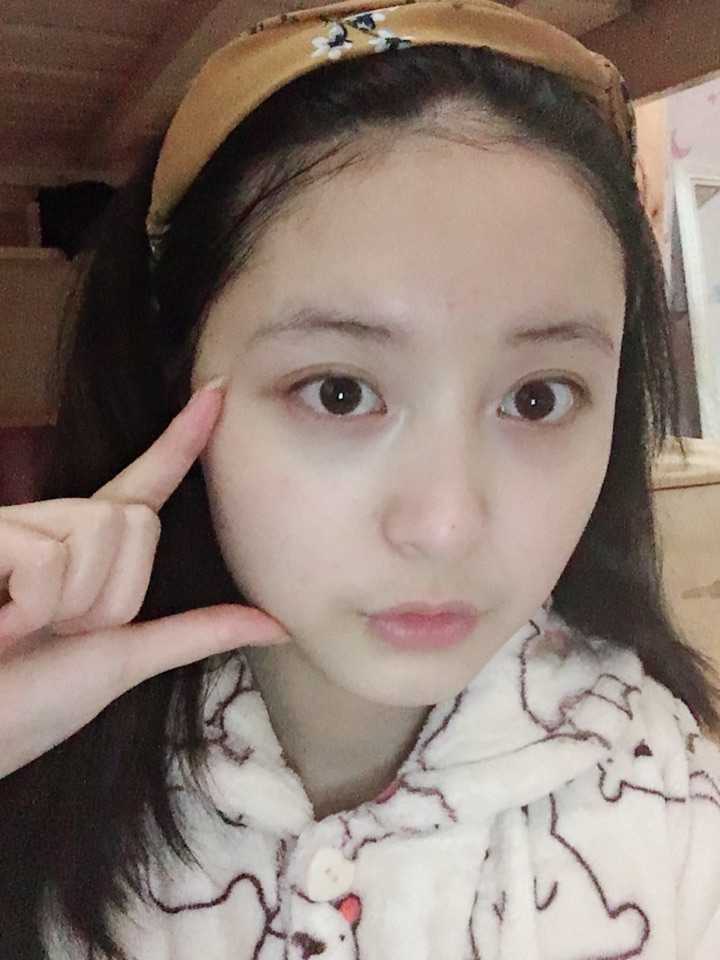 对了我还是油皮!夏天让我又爱又恨