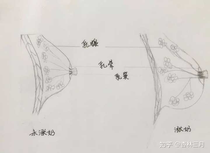 哺乳期涨奶时乳房有硬块怎么办？宝妈们有遇到一样情况的吗？
