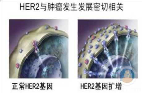 HER2基因