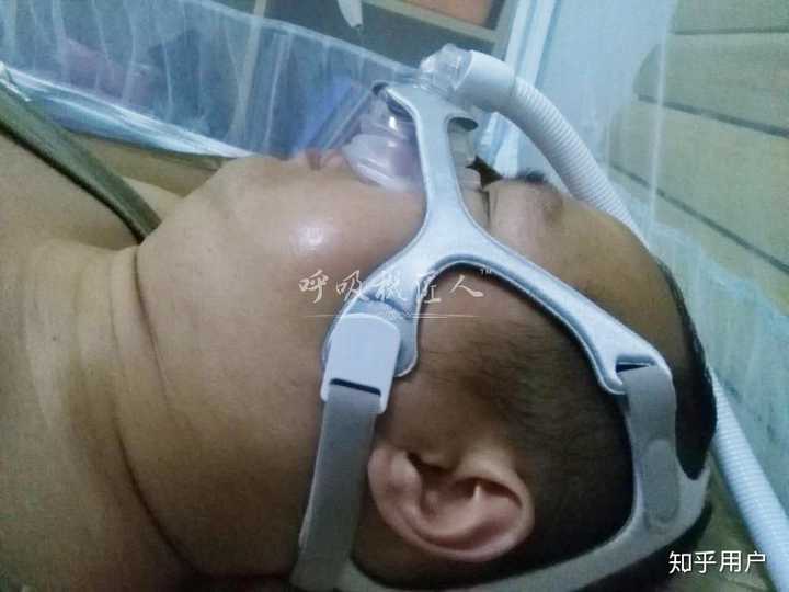 止鼾器是否真的管用 那一种类型的止鼾器管用呢 知乎 止鼾器是否真的管用 那一种类型的止鼾器管用呢 知乎