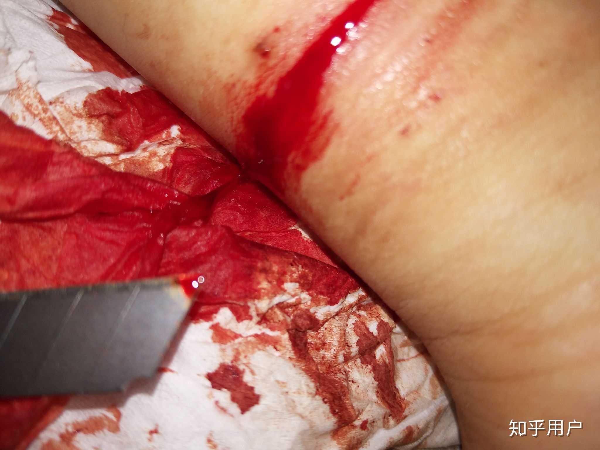 刀划伤胳膊图片图片