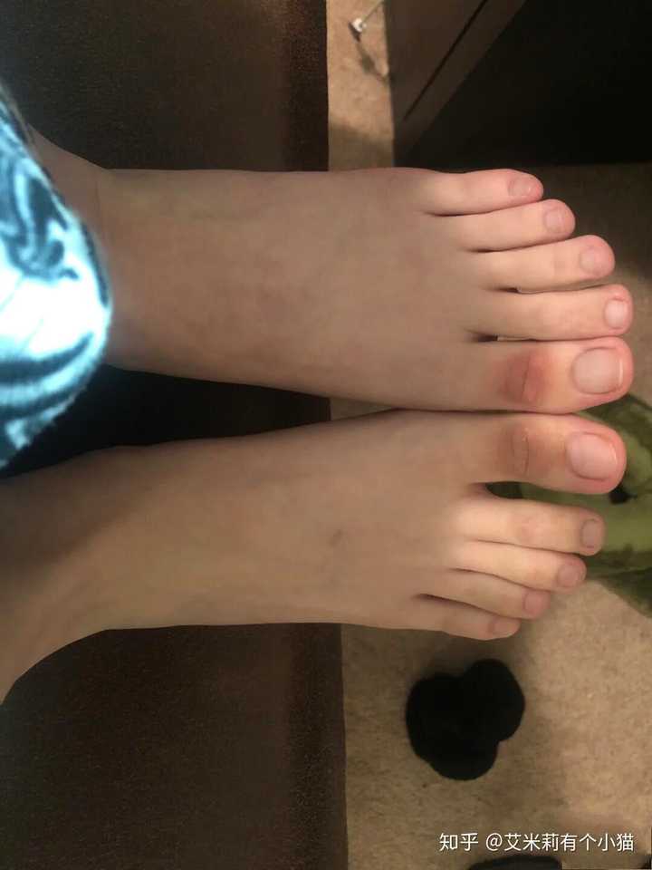 有哪些亲测有效的美白方法 知乎