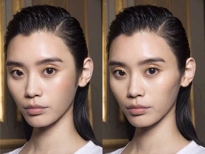 颧骨外扩除了整容还有没有什么方法?