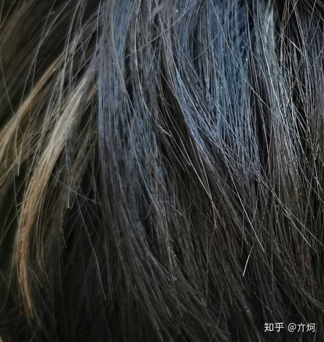 拥有不寻常的虹膜是种怎样的体验?