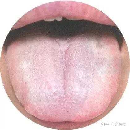 长期口臭怎么解决 知乎 长期口臭怎么解决 知乎