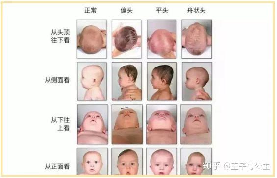 宝宝后脑勺图片位置图片