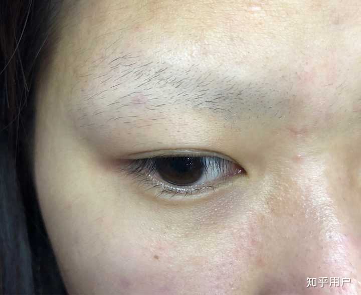 把眉毛全刮了大概多久长回来?