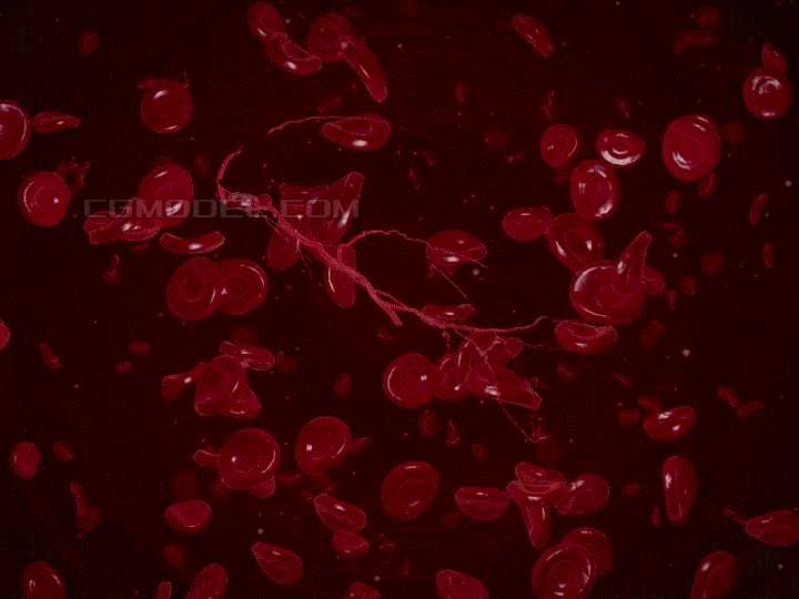 血栓分为四种,那么白色,红色,混合血栓都在身体哪些部位,或是怎么形成