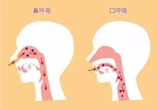 为什么晚上睡觉总用嘴巴呼吸 有什么危害吗 如何避免 知乎 为什么晚上睡觉总用嘴巴呼吸 有什么危害吗 如何避免 知乎