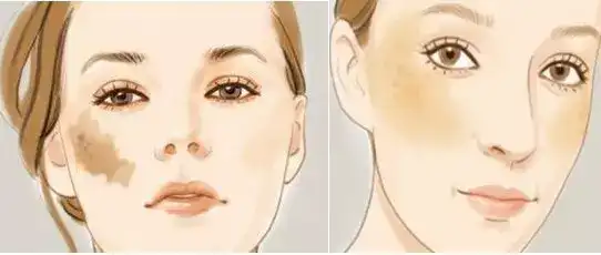 v2-2e5ef336973861cda6ce3f78c4c63d03_hd.jpg