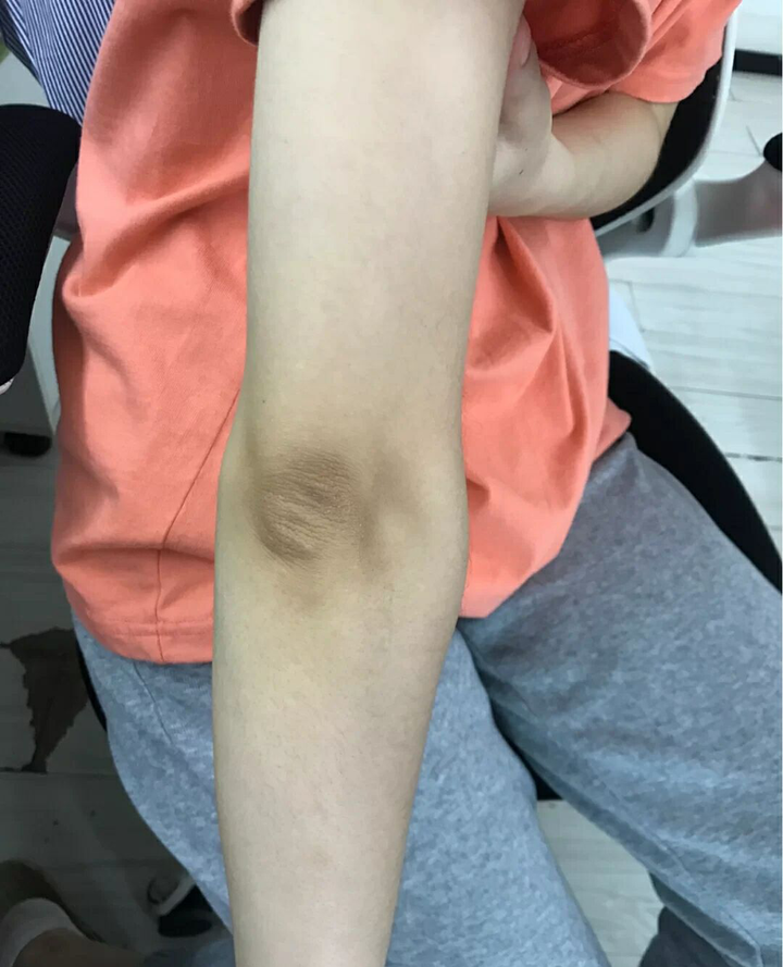 有哪些可以去手肘膝盖黑的磨砂膏 知乎 有哪些可以去手肘膝盖黑的磨砂膏 知乎