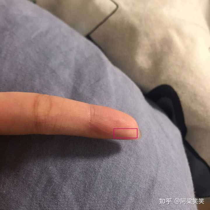 平时手指被割伤应该怎么处理? - 知乎
