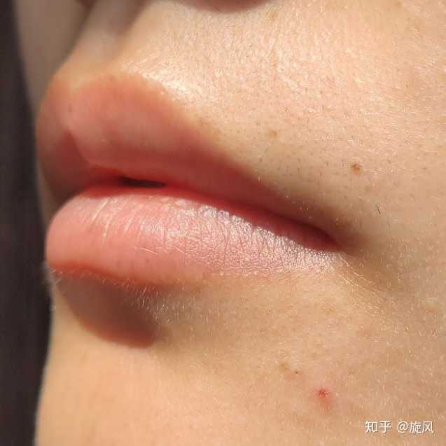 冰点脱毛仪脱唇毛效果如何？