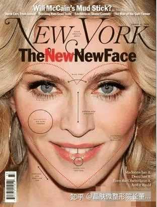 欧美白人或者中东白人整形的话一般是整哪里 晶肤微整形院长董薇薇的回答 知乎