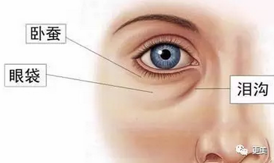 什么是 卧蚕 它跟眼袋有什么区别 知乎 什么是 卧蚕 它跟眼袋有什么区别 知乎