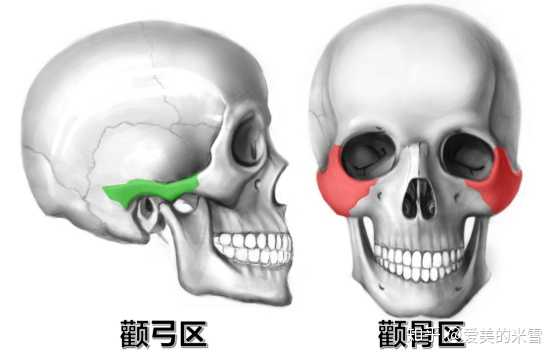 颧骨内推是怎样一种手术？ - 知乎