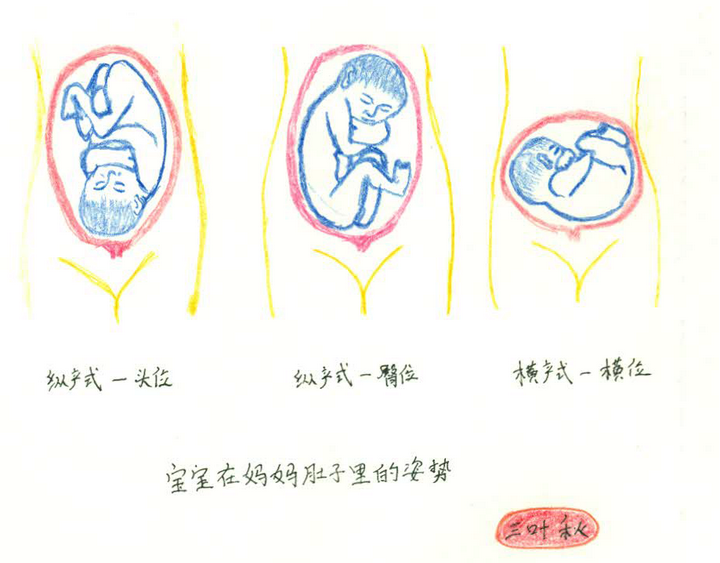 22种胎位图解图片