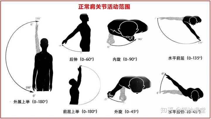 肩周炎最佳治疗方法是什么 知乎 肩周炎最佳治疗方法是什么 知乎