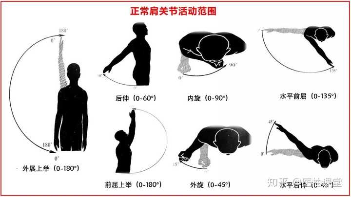 肩周炎最佳治疗方法是什么 知乎