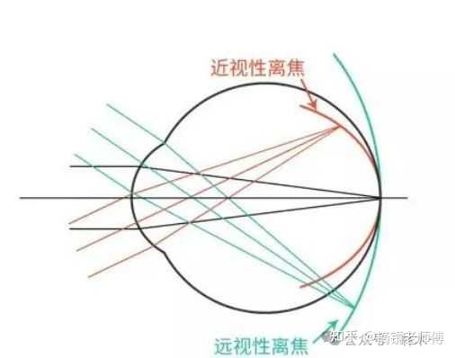 OK镜到底有没有用?用处有多大? - 知乎
