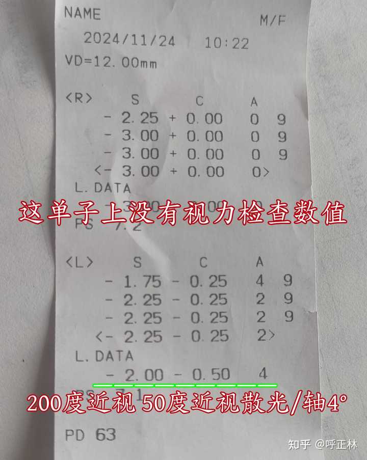 我的视力和度数分别是多少呀? - 知乎