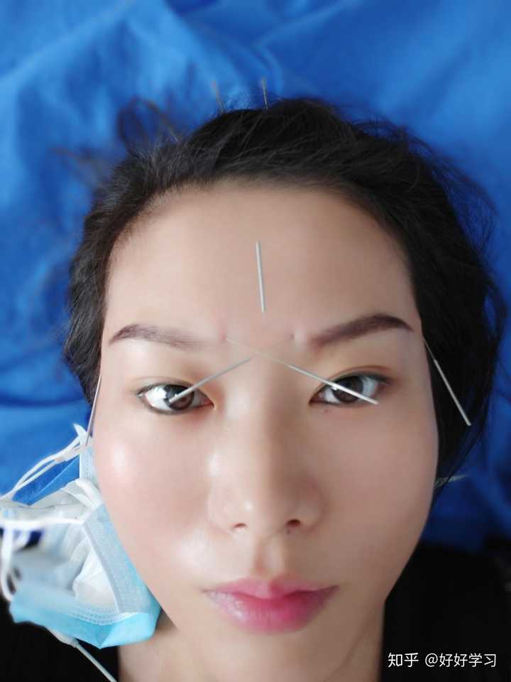 有没有眉骨疼痛 鼻骨疼痛的啊 知乎 有没有眉骨疼痛 鼻骨疼痛的啊 知乎