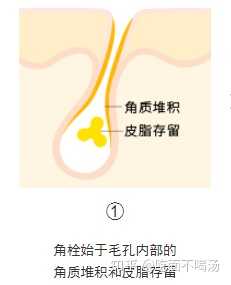 67登錄加入知乎毛孔粗大黑頭皮膚清潔收縮毛孔毛孔毛孔長摸起來