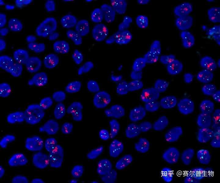 什么是荧光原位杂交(FISH)技术? - 知乎