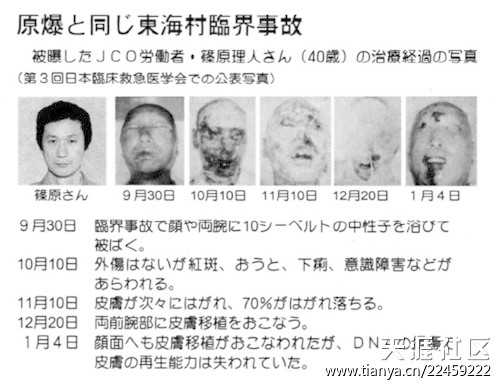 如何看待茨城县大洗町的日本原子能研究开发机构大洗研究开发中心发生5名操作人员遭到辐射的事故 萌之检事正的回答