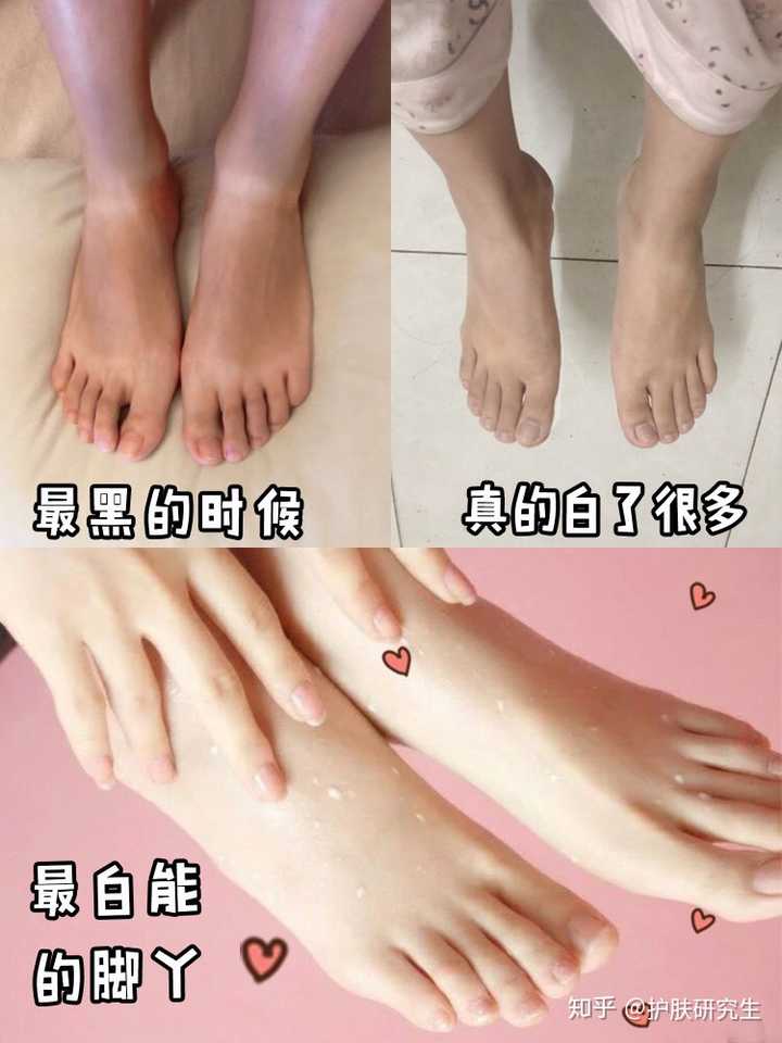手和脚被晒黑了怎么快速白回来 知乎