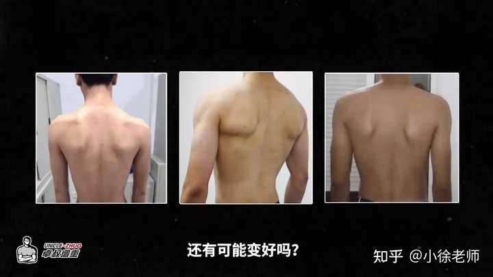 为什么有些人背部脊柱沟凹进去很深，而有的人凸出来很明显？ - 知乎