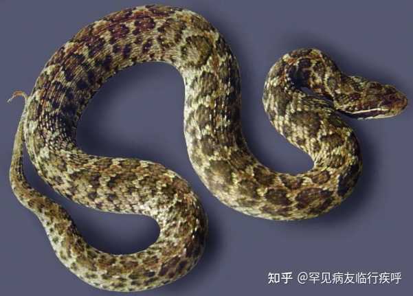 广东女子被咬伤后拎着毒蛇冲进医院,被毒蛇咬伤后第一时间如何自救? - 知乎