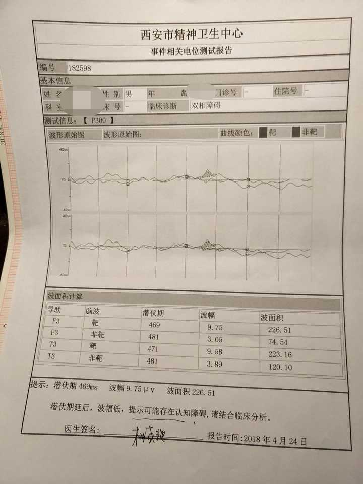 如何判断自己的抑郁程度 知乎